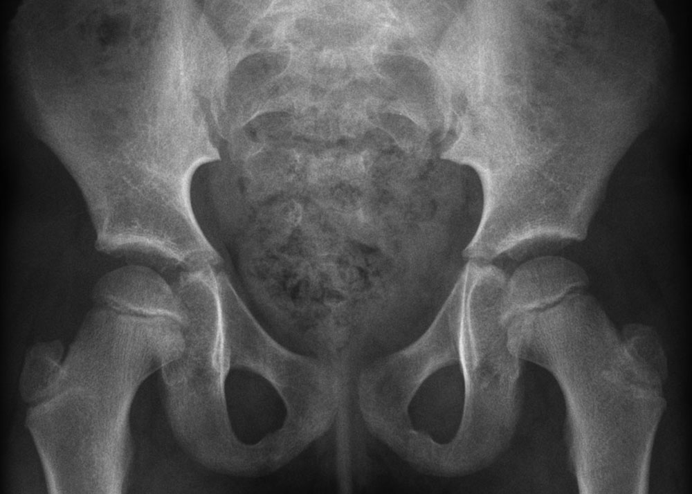 Imagerie de l'enfant et prénatale - Radiographie
