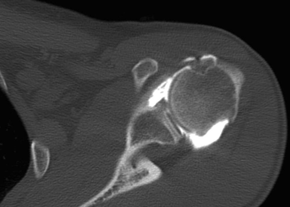 Imagerie de l'adulte - Scanner | radiologie, échograhie, scanner ...