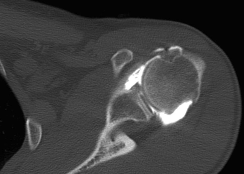 Arthroscanner