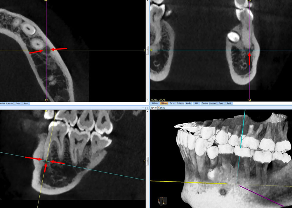 Dentascanner